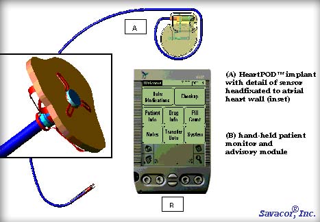 HeartPOD