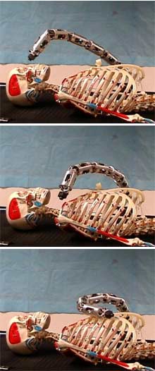 Медицинский робот-змея