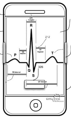 iPhone cardiac sensor