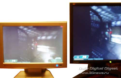 MacroView MV5000