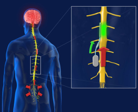 http://www.3dnews.ru/_imgdata/img/2010/12/15/603686/Spinal-Implant.jpg